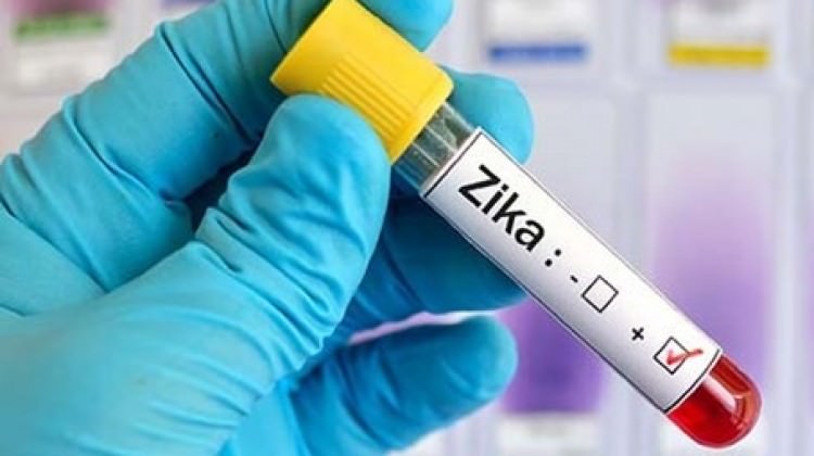 zika_virusu_nedeniyle_2_olum_1463817694_0402.jpg