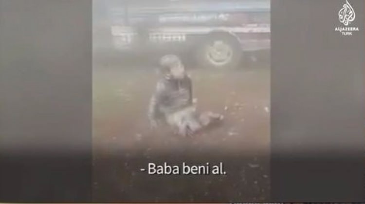 Esed rejiminin saldırılarında bacaklarını kaybetti Esed rejiminin saldırılarında bacaklarını kaybetti