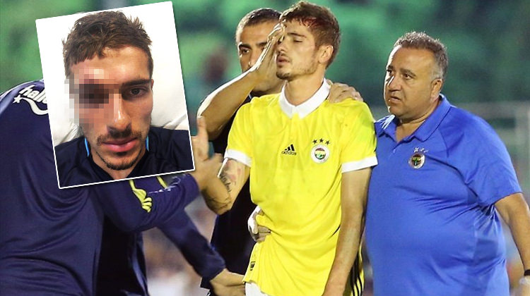 Neustadter bu hale geldi! 10 dikiş Neustadter bu hale geldi! 10 dikiş